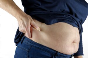 abdominoplastie après grossesse
